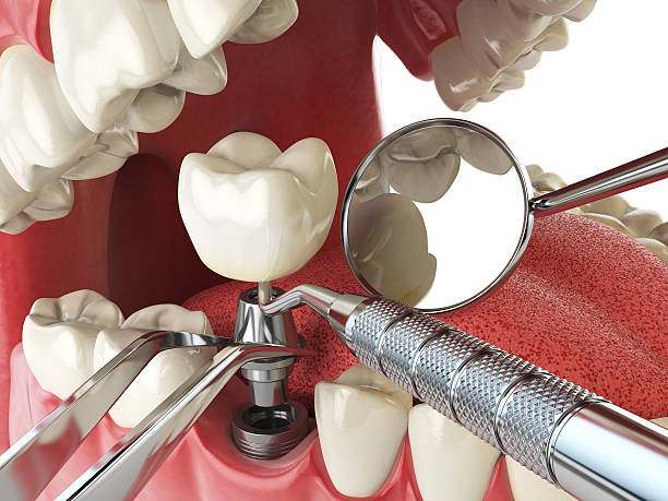 Best Emergency Gum Treatment in Penn Wynne, PA